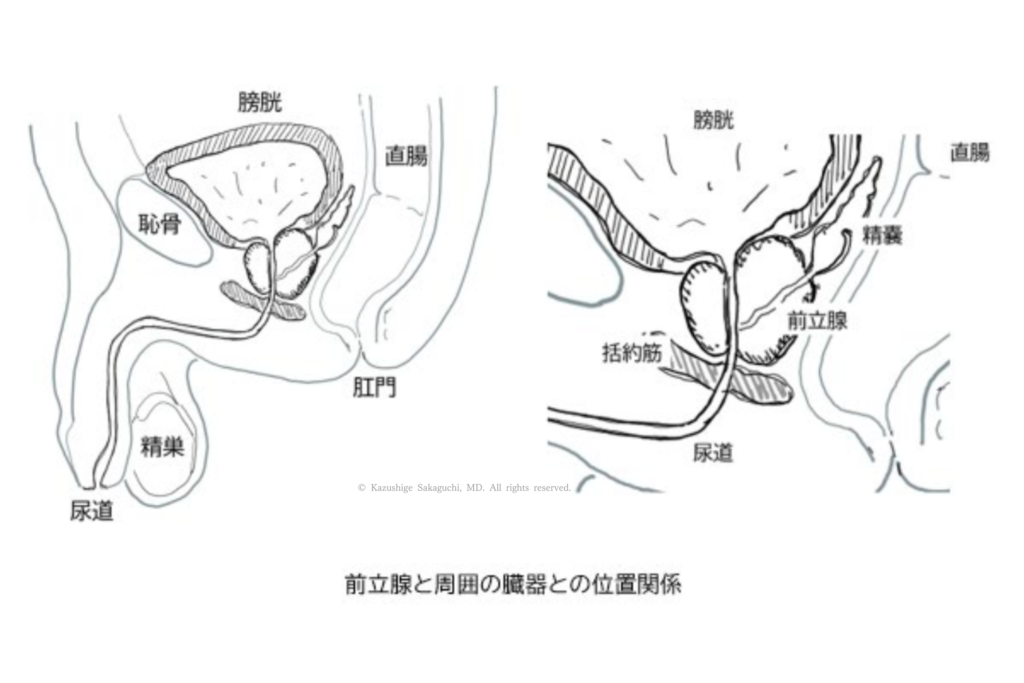 前立腺と膀胱・直腸・精嚢の位置関係を別角度から示した図