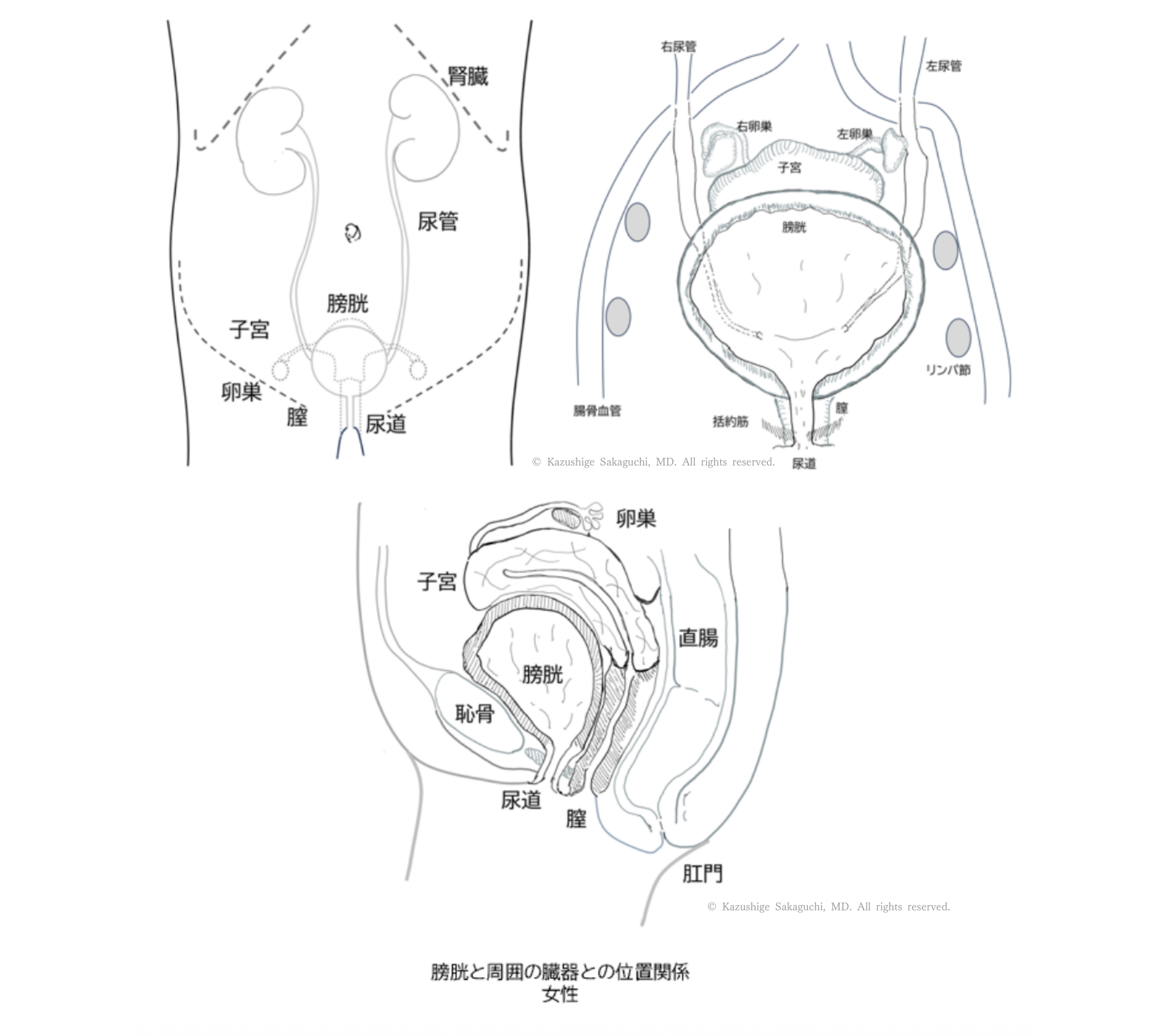 女性の膀胱と腎臓・尿管・子宮・卵巣・腟・直腸との位置関係を示した解剖図